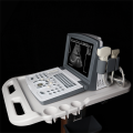 Portable Black and White Ultrasound Scanner for Gynecology