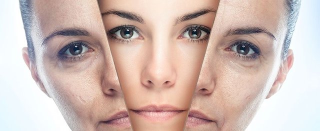 hyaluronic acid 