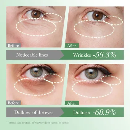 Centella Anti-Wrinkle Hydrating Eye Cream