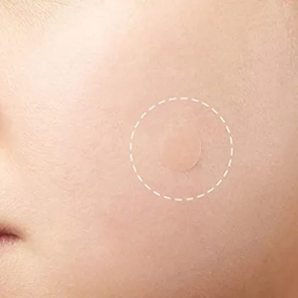 Acne Patch Waterproof Acne Dots Hydrocolloid Acne Sticker