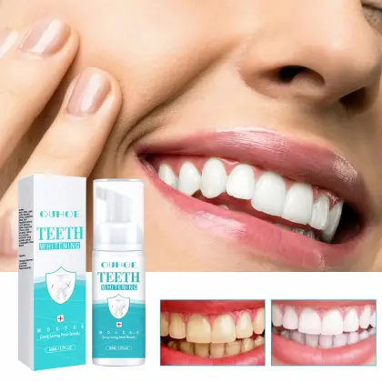 Private Label OEM 50ml Oral Hygiene Tooth Whitening Foam