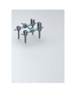 Internal Spine Retainers 1(SCS)