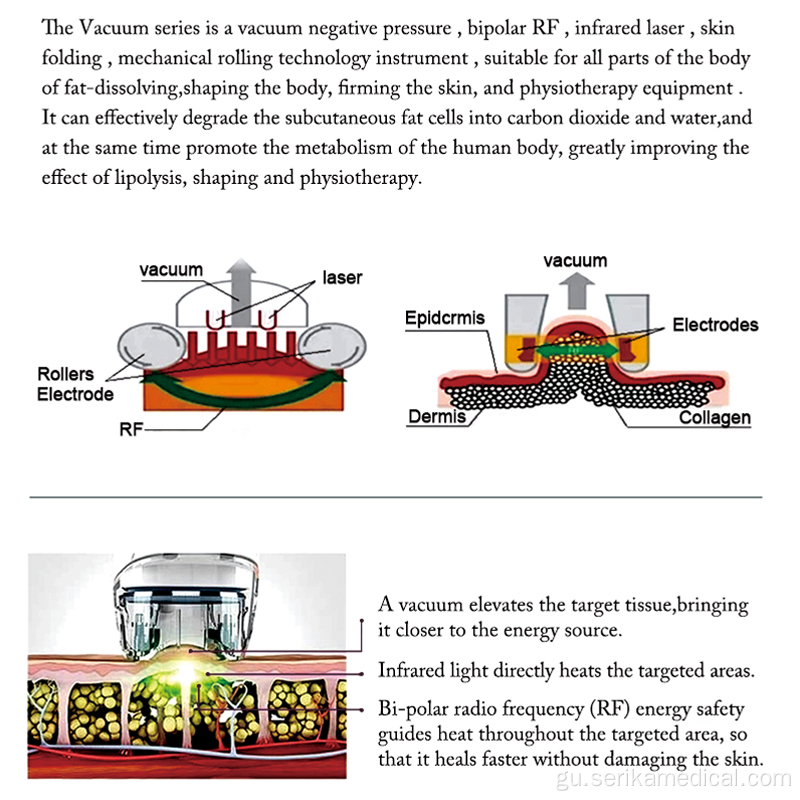 635nm વેક્યુમ પોલાણ રોલર આરએફ સ્લિમિંગ મશીન