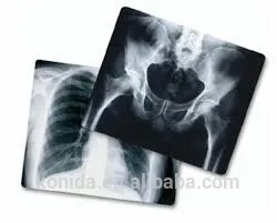 medical supplies xray machine camera best selling products