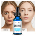 30ml Glycolic Acid Serum