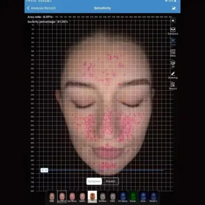 Portable Skin Analyzer: Visia Skin Analysis Machine - Magic Mirror Skin Scanner