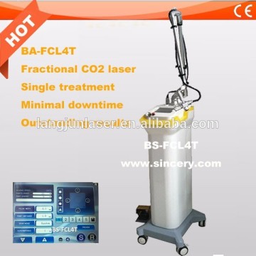 Hot sell low price co2 laser machinery