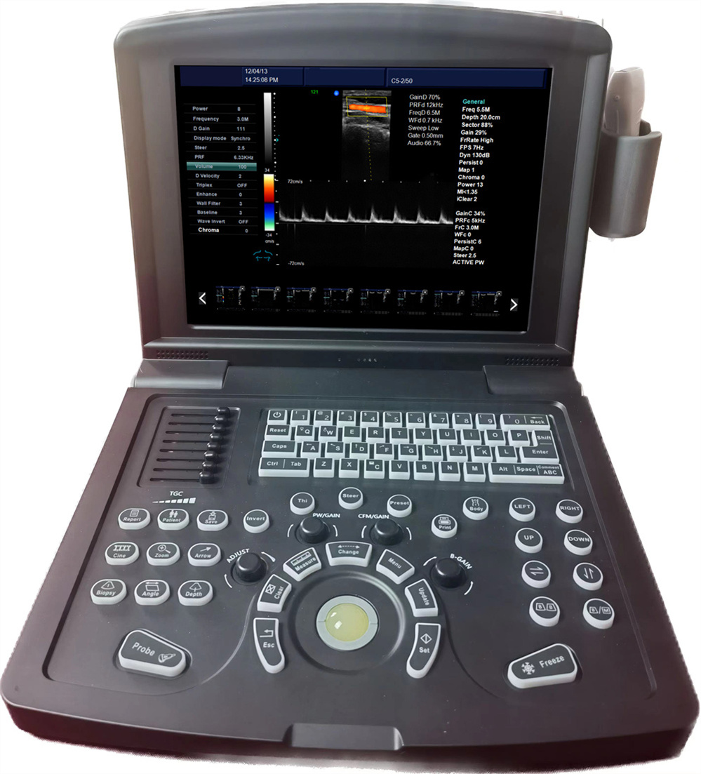 Tragbarer Farbdoppler -Ultraschallscanner zum Verkauf