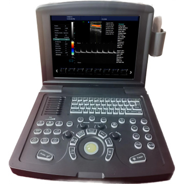 Portable Color Doppler Ultrasound Scanner for Sale