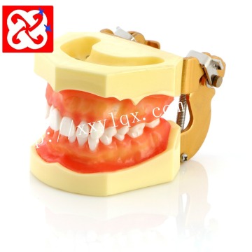 Model gigi periodontal permen karet lunak yang dapat dilepas untuk praktik dan pendidikan