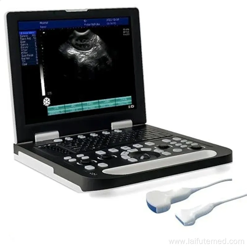 Portable 4D Ultrasound Machine for Veterinary Use
