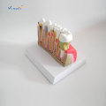 Συνδυασμένο μοντέλο κοινών οδοντικών ασθενειών