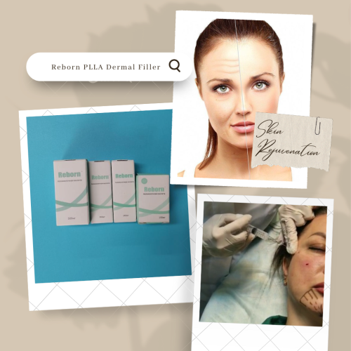 Dermal Fillers Laugh Lines Non Surgical Hands Penis Hip Treatments Dermal Fillers Manufactory