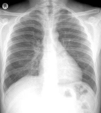 medical dry film,x ray film,digital film,CT Film,DR film