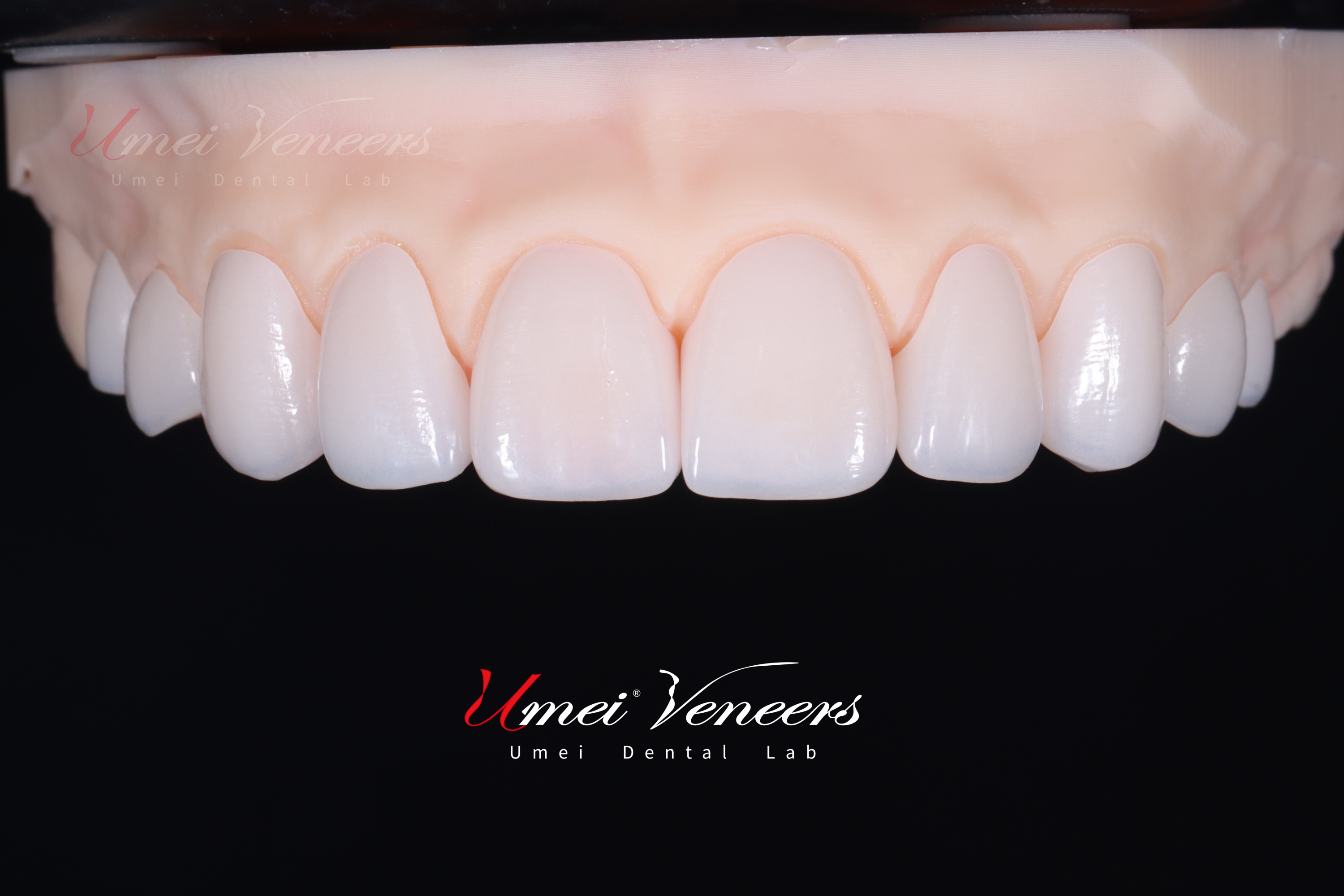 Appiantaggi a strati di zirconia Zirconia Layered Veneers
