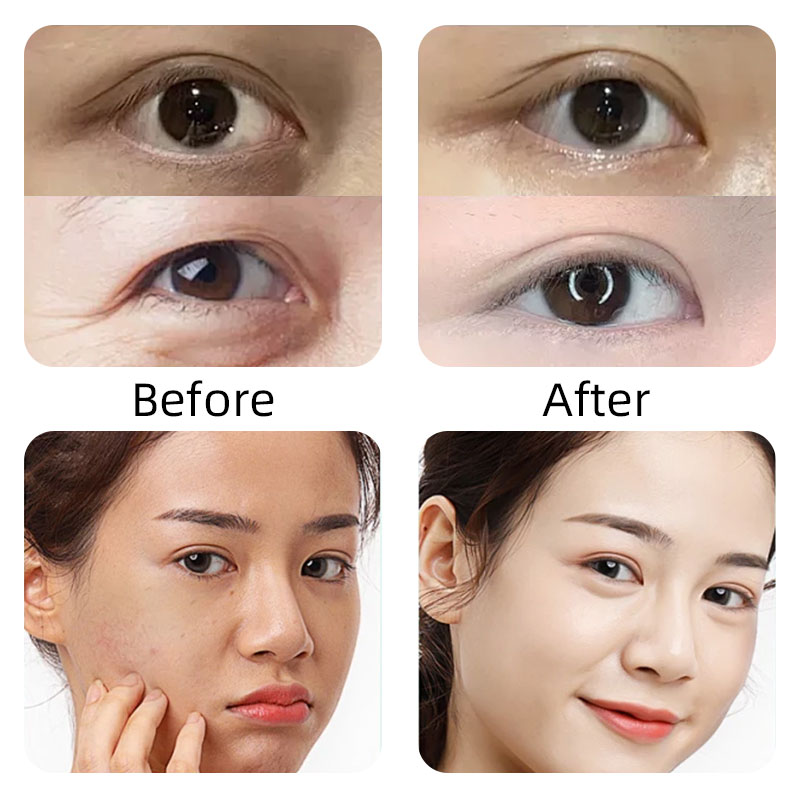 Golden Eye Charm Eye Sculpting Instrument
