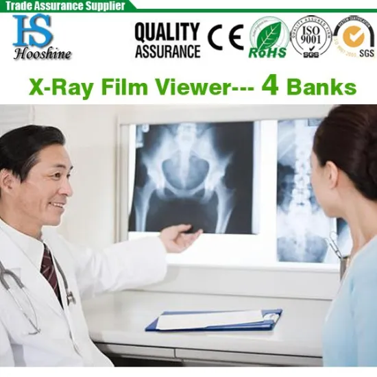 X-ray image viewing box( 3 banks)---Medical Equipment