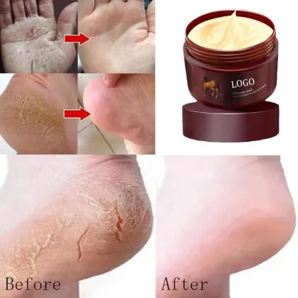 Private Label Dry Foot Crack Repair Horse Oil Hand and Foot Moisture Cream