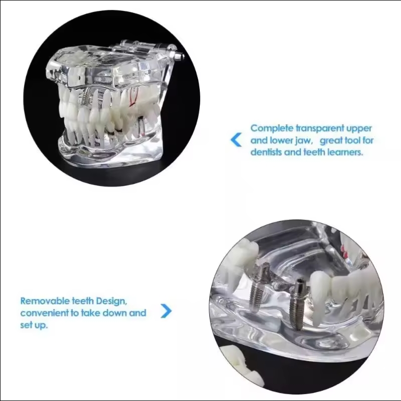 Teeth Model