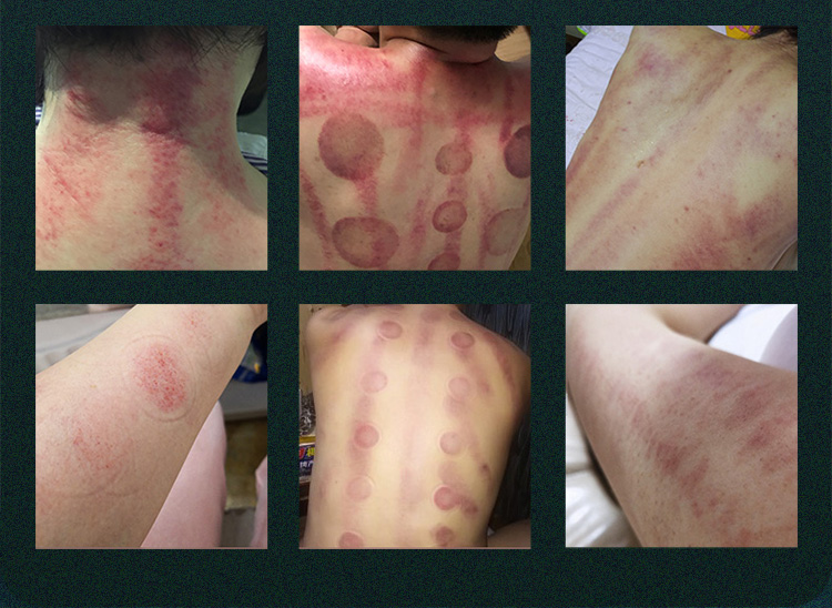 cavitation machine 80k