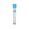 Tube Prp de gel de citrate de sodium additif pour vaisseaux sanguins