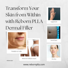 Non Surgical Neck Lift Hip Enhance PLLA Fillers