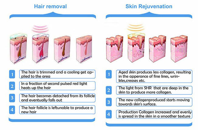 3 in 1 Ipl Shr Opt Hair Removal Elight RF Face Lifting Nd Yag Tattoo Removal Laser Beauty Machine