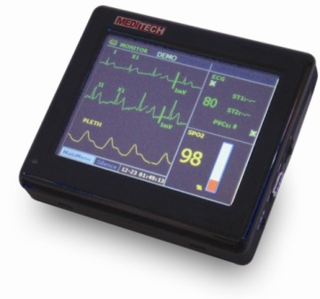 Palm-size patient monitor