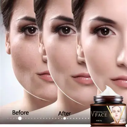 Private Label V-Shape Face Slimming Cream for Chin Fat Reduction