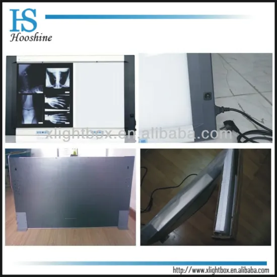 Medical x-ray film illuminator/ X-ray viewer