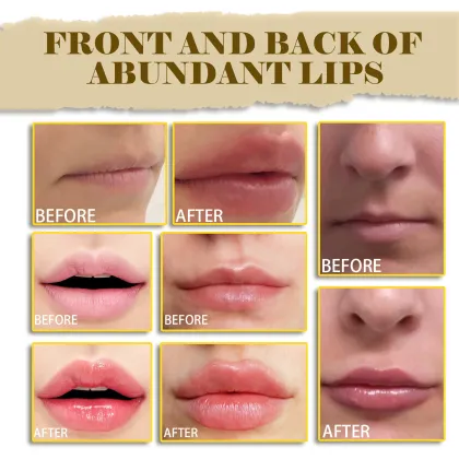 OUHOE Lip Oil: Moisturizing & Anti-Dryness Lip Treatment