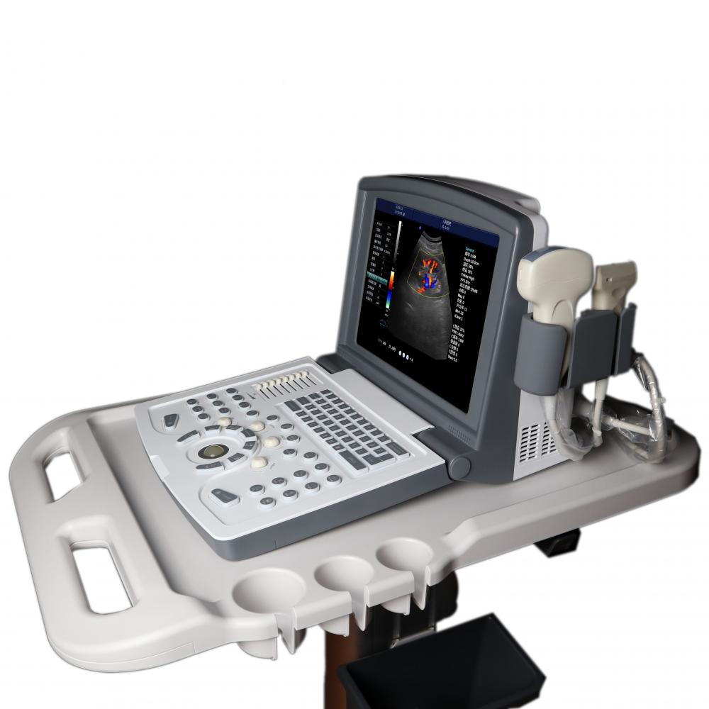 Machine à ultrasons Doppler couleur portable pour l'obstétrique