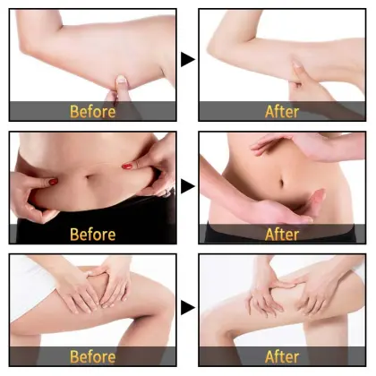 Private LOGO Slimming Cream: Burn Fat for Waist, Leg, and Body Weight Loss