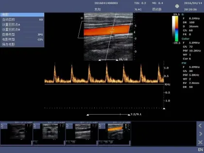 Krayson KR-C30 High-Performance Color Ultrasound Device