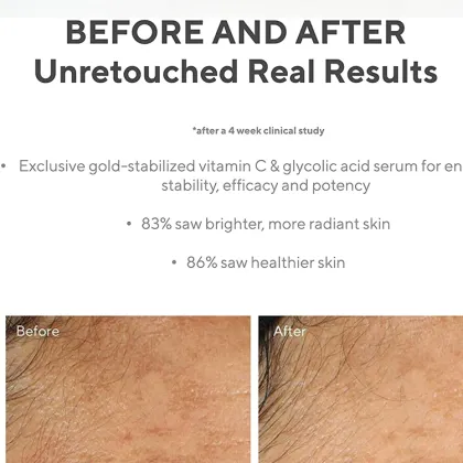 Vita-C Glycolic Serum - Brighten Your Skin with Vitamin C Face Serum
