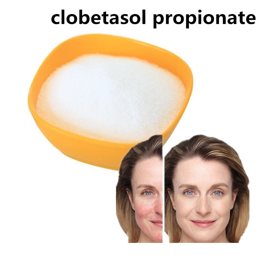 Clobetasol Propionate