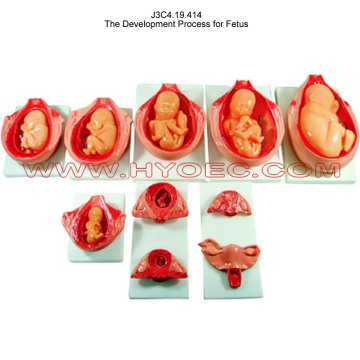 The Development Process for Fetus-J3C4.19.414