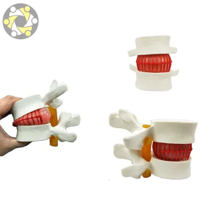 Vertebral Spine Simulator for Lumbar Disc Herniation Medical Science Model