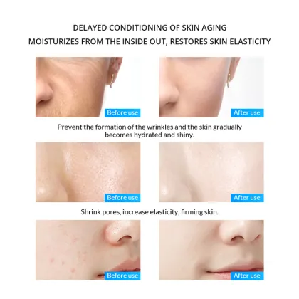 OEM Private Label Repair Damaged Skin Moisturizing Face Serum After Microneedling