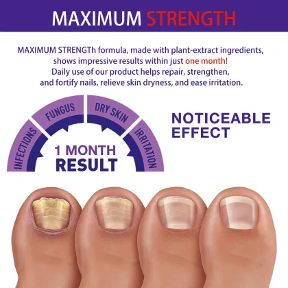 YURHERSU Foot Care Nail Repair Essence