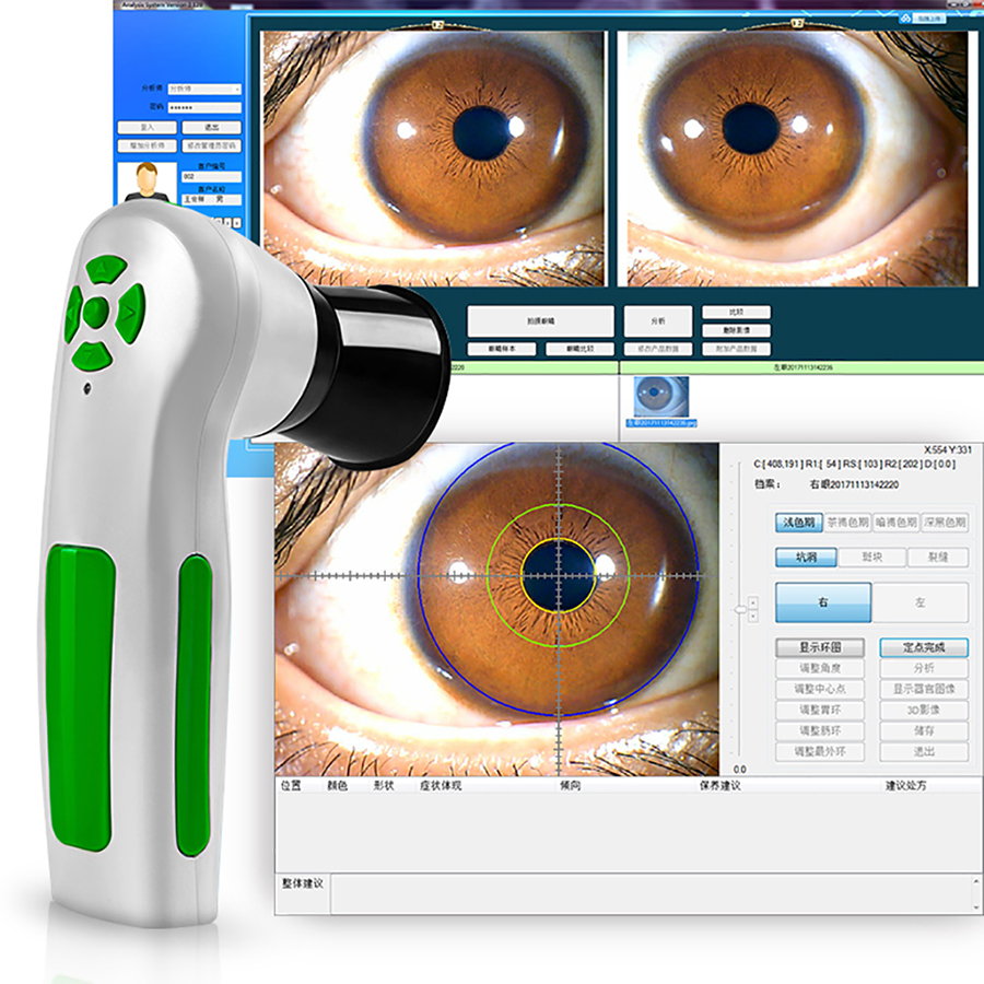 body scanner biometric eye iris iridology iriscope camera