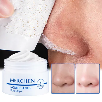 Wholesale Skincare: Pore Cleanser, Mud Mask, Acne Treatment & Whitening Face Clay Mask