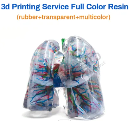 3D Printed medical implants