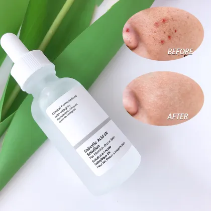 Serum Frosted Glass Bottle with Dropper for Acne and Blackhead Removal Salicylic Acid Skincare Essence