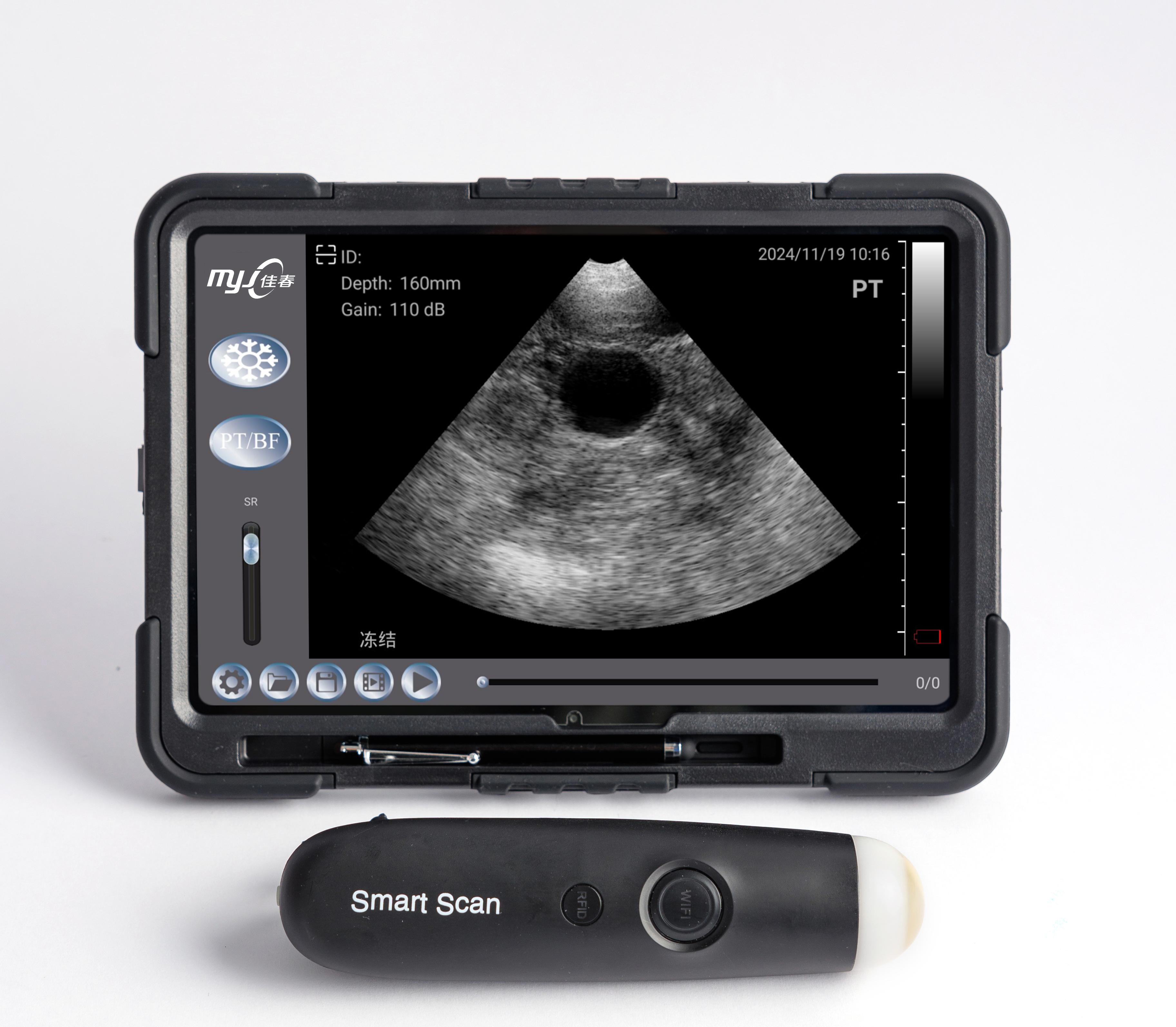portable ultrasound machine for sale