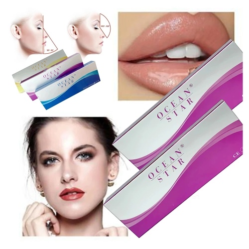 Dissolve Hyaluronic Acid Dermal Fillers Ocean Star Hyaluronic Acid Derm Deep Dermal Filler Supplier