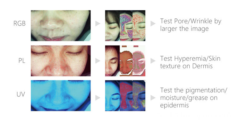 3d Skin Analyzer