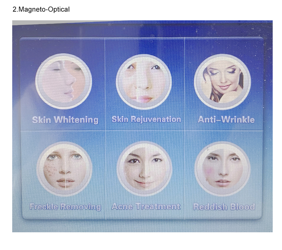 IPL Hair Removal Skin Rejuvenation Elight OPT IPL SHR Laser Beauty Machine