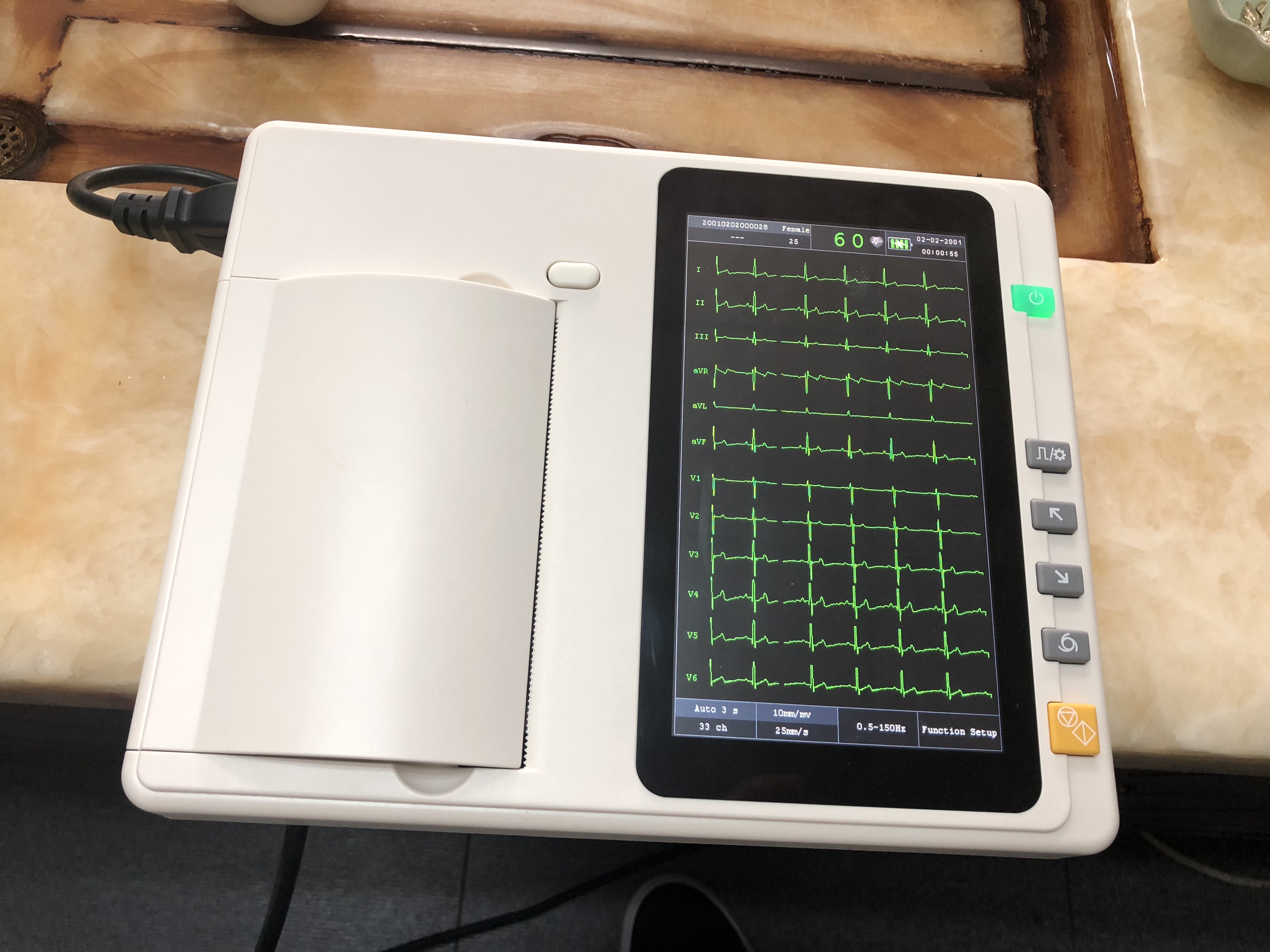 Digital 3-Channel EcG