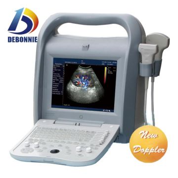 Full Digital 2D Color Doppler Ultrasound Scanner